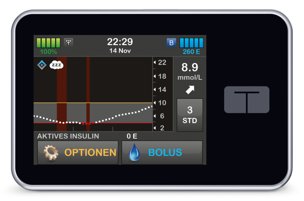 tslim X2 Insulinpumpe Diabetes Vitalaire.ch