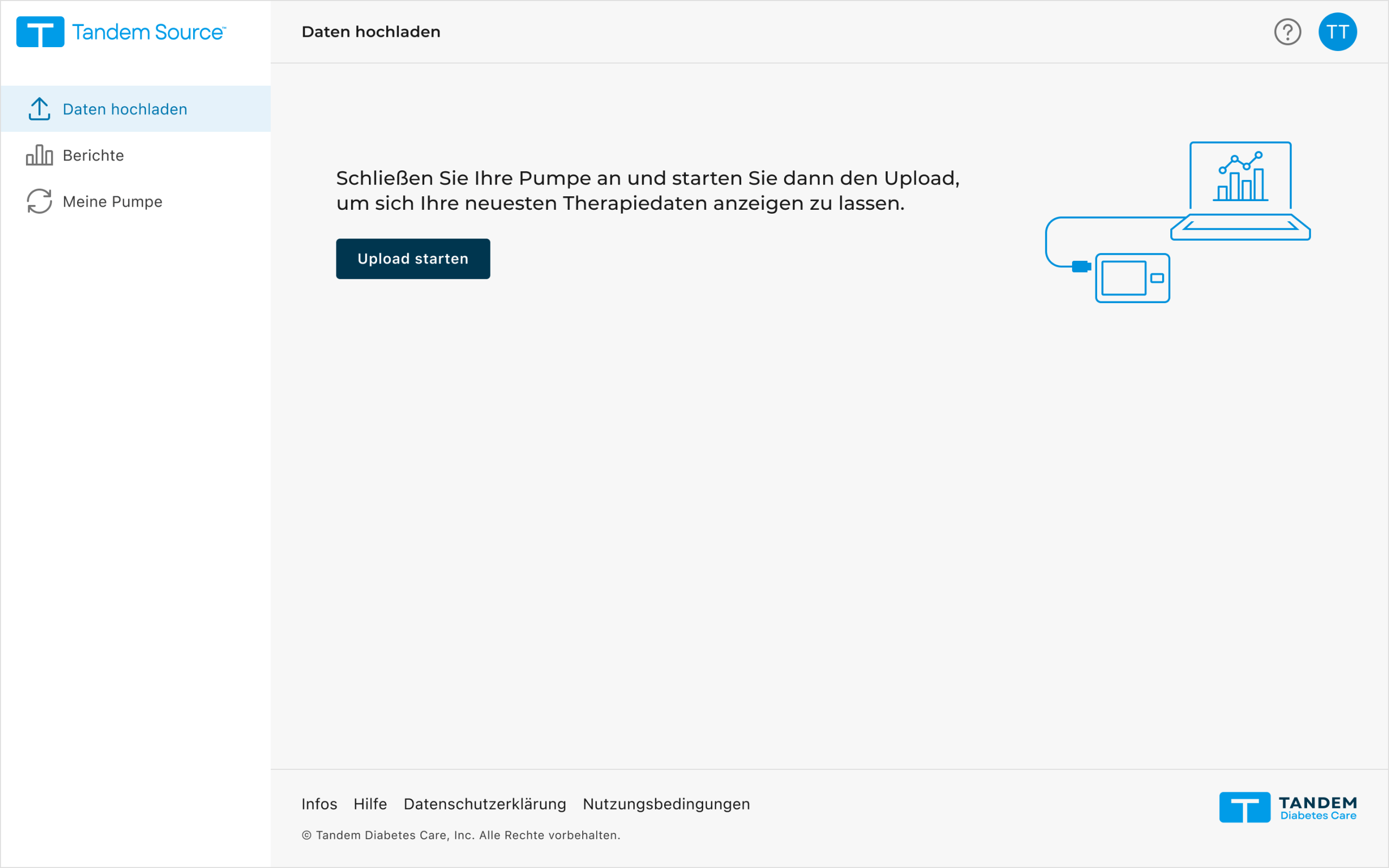 Tandem Source, Personal, Upload Pump, Start, DE, CM-003093