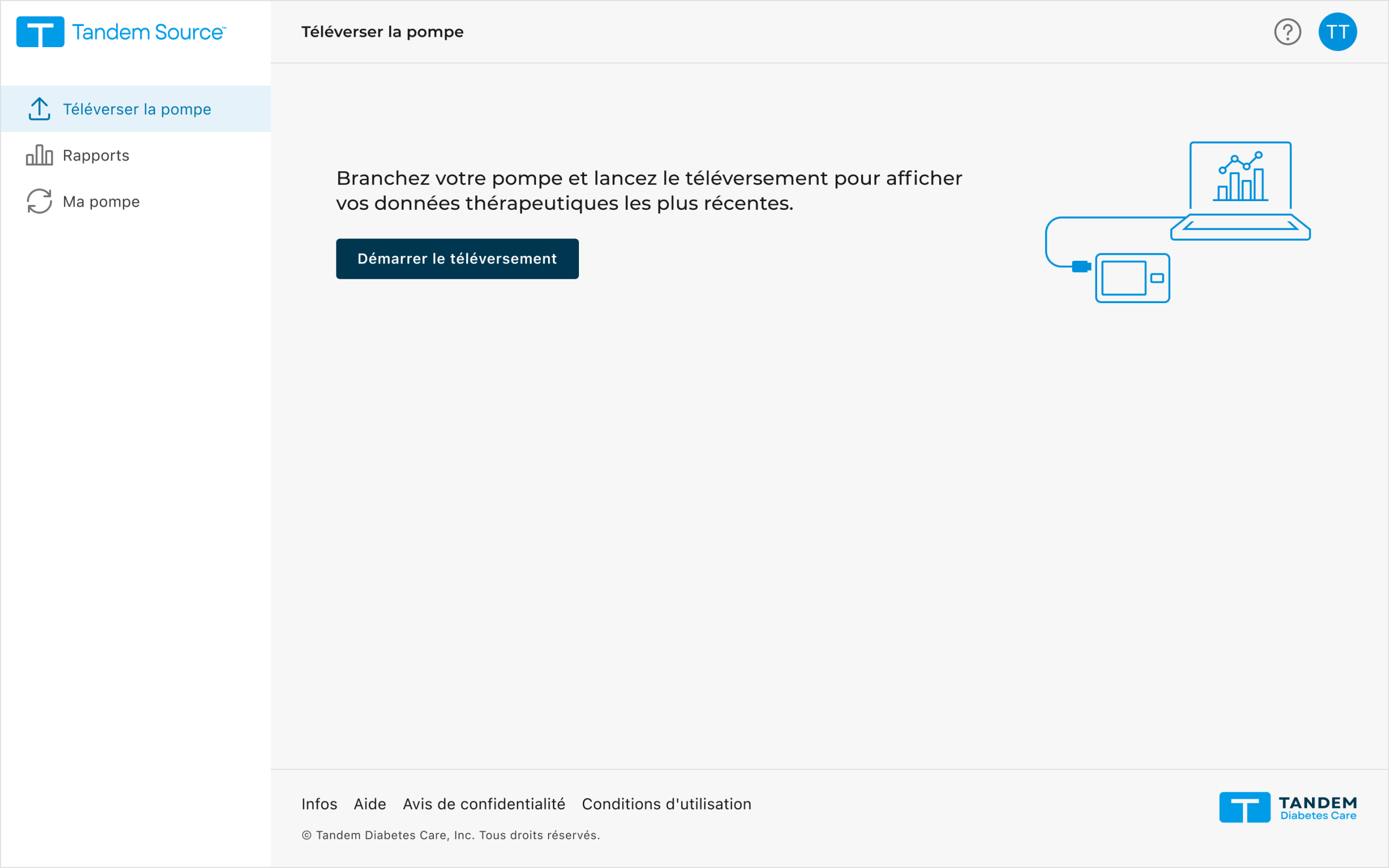 Tandem Source, Personal, Upload Pump, Start, FR, CM-003093
